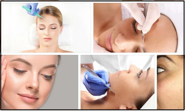 Dermaplaning Benefits: The Secret to Smooth, Glowing Skin
