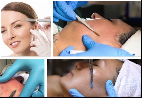 Benefits of Dermaplaning at Home – Is Dermaplaning Easy to Do at Home?