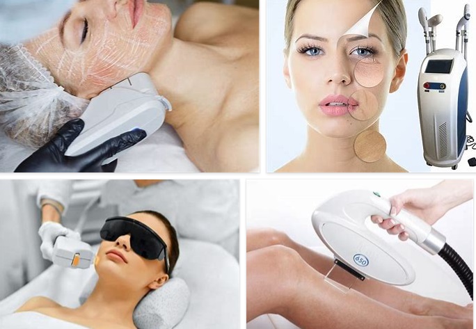 IPL Benefits – What Are The Benefits Of IPL Laser?